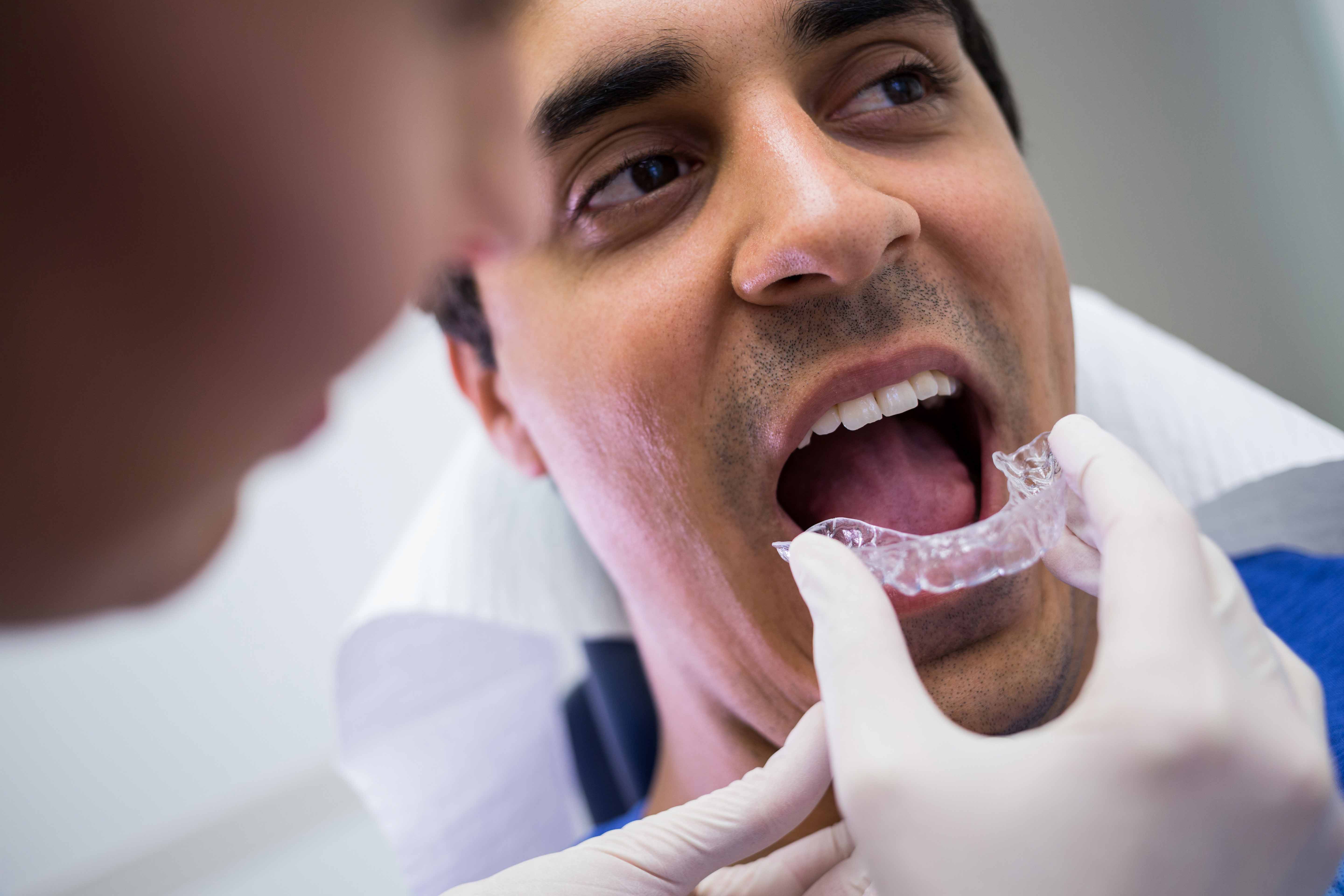 Aparelhos dentários Invisíveis