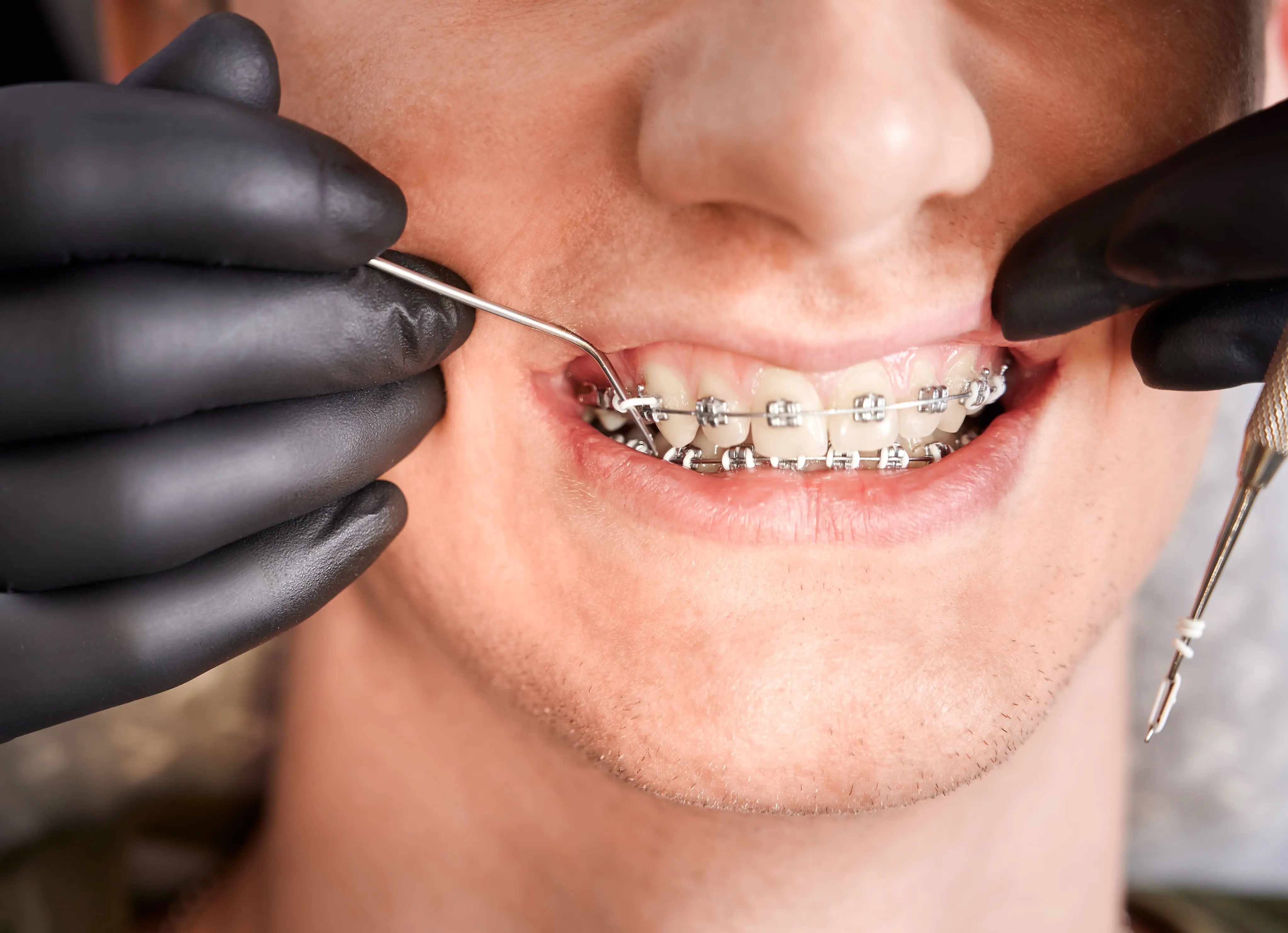 Endodontia
